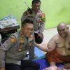 Kapolres Bogor Jenguk dan berikan bantuan moril juga medis Penderita Obesitas